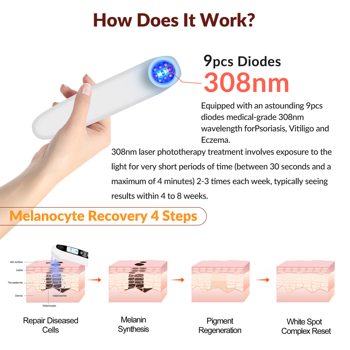 ZJZK 308nm UVB Light Therapy Device Professional Treatment for Skin Diseases