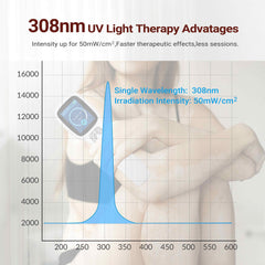 ZJZK 308nm excimer device - Effective Natural Light Therapy for Psoriasis, Vitiligo and Eczema at home