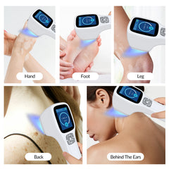 ZJZK Excimer Therapy UV Light And Psoriasis UVB Light For Viral Infectious Skin Disease